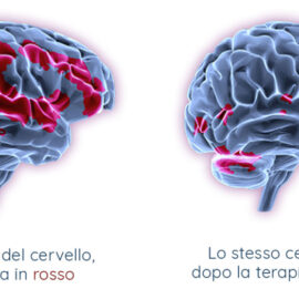 Il trauma superato cambia posto nel cervello